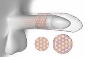 Increased penis in volume